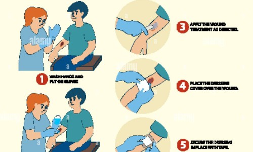 鼻咽咳出一粒很臭图片-鼻咽部恶臭颗粒网鼻咽腔里有股难闻的臭味怎么办知识网站,分享鼻咽部引起的口臭怎么治疗大全
